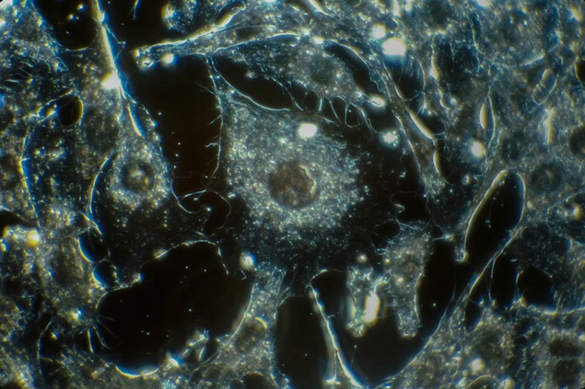 Ученые выяснили, как определенные бактерии E. coli вызывают рак толстой кишки