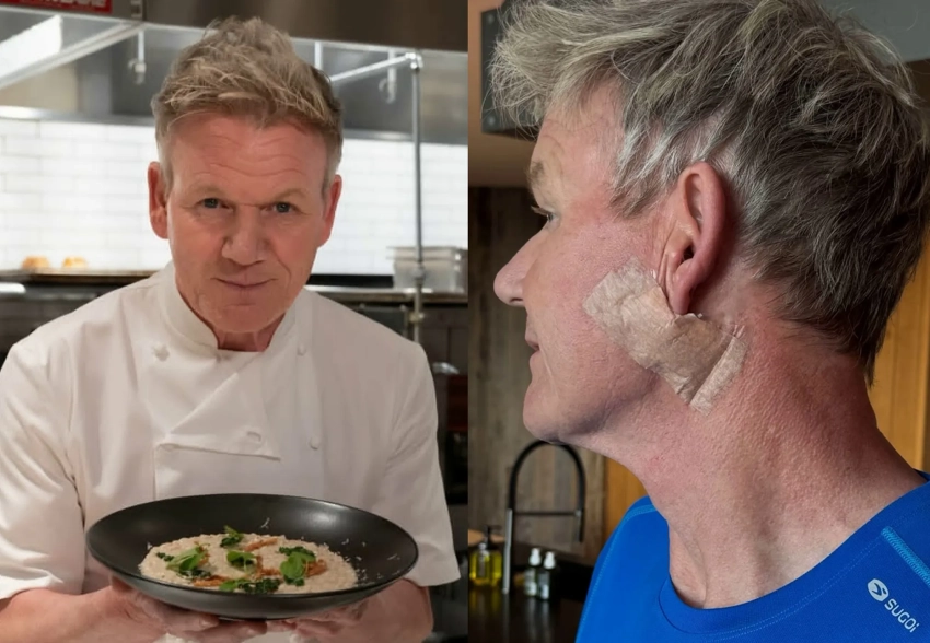 "Не забывайте про солнцезащитный крем". Известный шеф-повар Гордон Рамзи перенёс операцию по поводу рака кожи