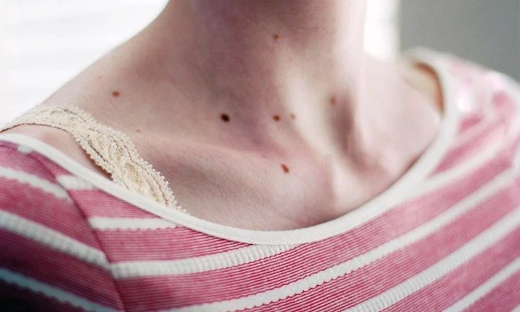 Эзотерик рассказала, о чем говорят родинки в виде треугольника на теле